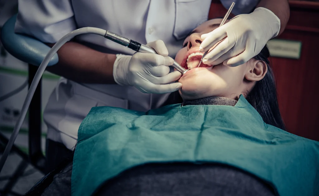 Diagram showing the stages of tooth decay, progressing from enamel caries to periodontitis, illustrating the importance of timely treatment such as root canals. Big Sky Family Dental offers root canals to treat severe tooth infections and prevent further complications.