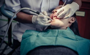 Diagram showing the stages of tooth decay, progressing from enamel caries to periodontitis, illustrating the importance of timely treatment such as root canals. Big Sky Family Dental offers root canals to treat severe tooth infections and prevent further complications.